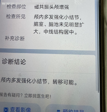 头核磁.png